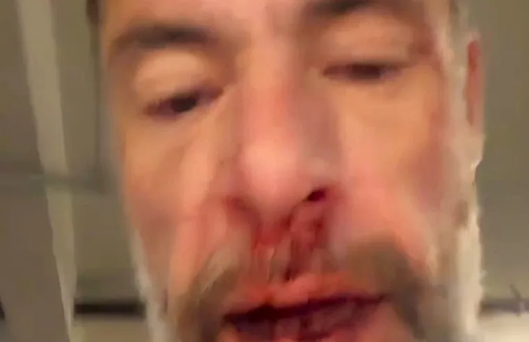 Deputado nega agressão após denúncia e divulga vídeo com ferimentos